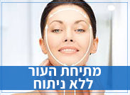 מתיחת העור ללא ניתוח